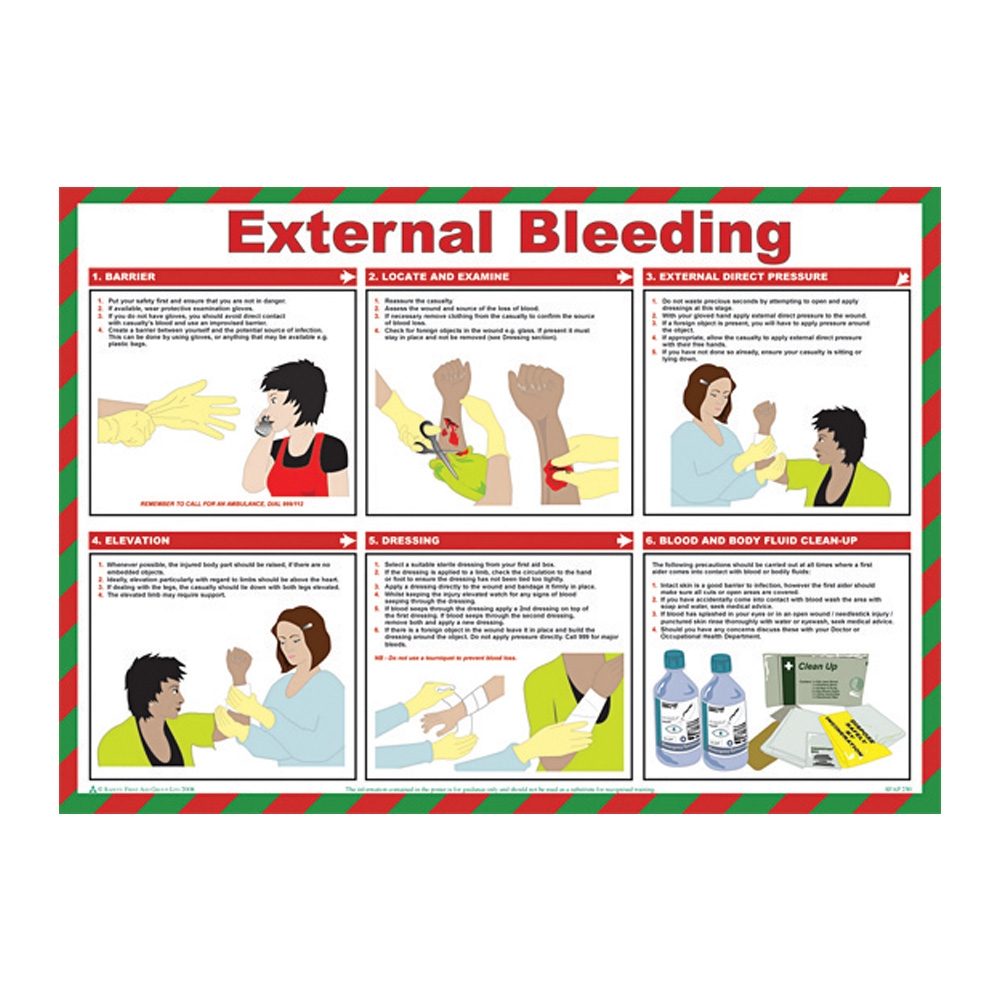 External Bleeding Laminated Poster - 590mm x 420mm